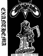 Exanthema : The Dead Shall Rise Exanthema : The Dead Shall Rise